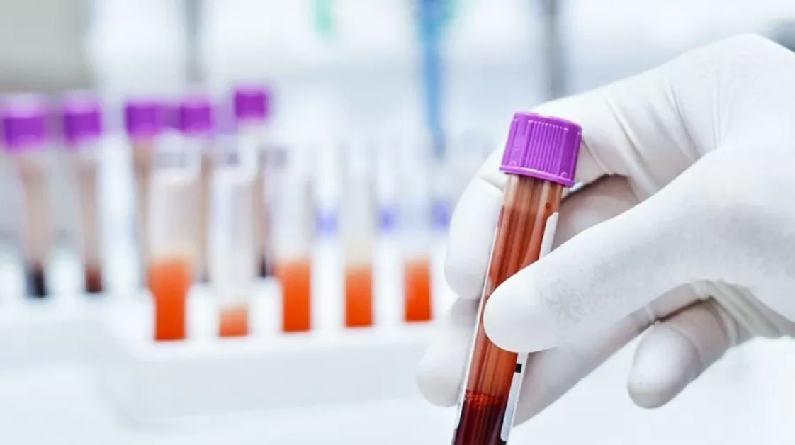 Estudo analisa tipos sanguíneos e a contaminação por Covid-19